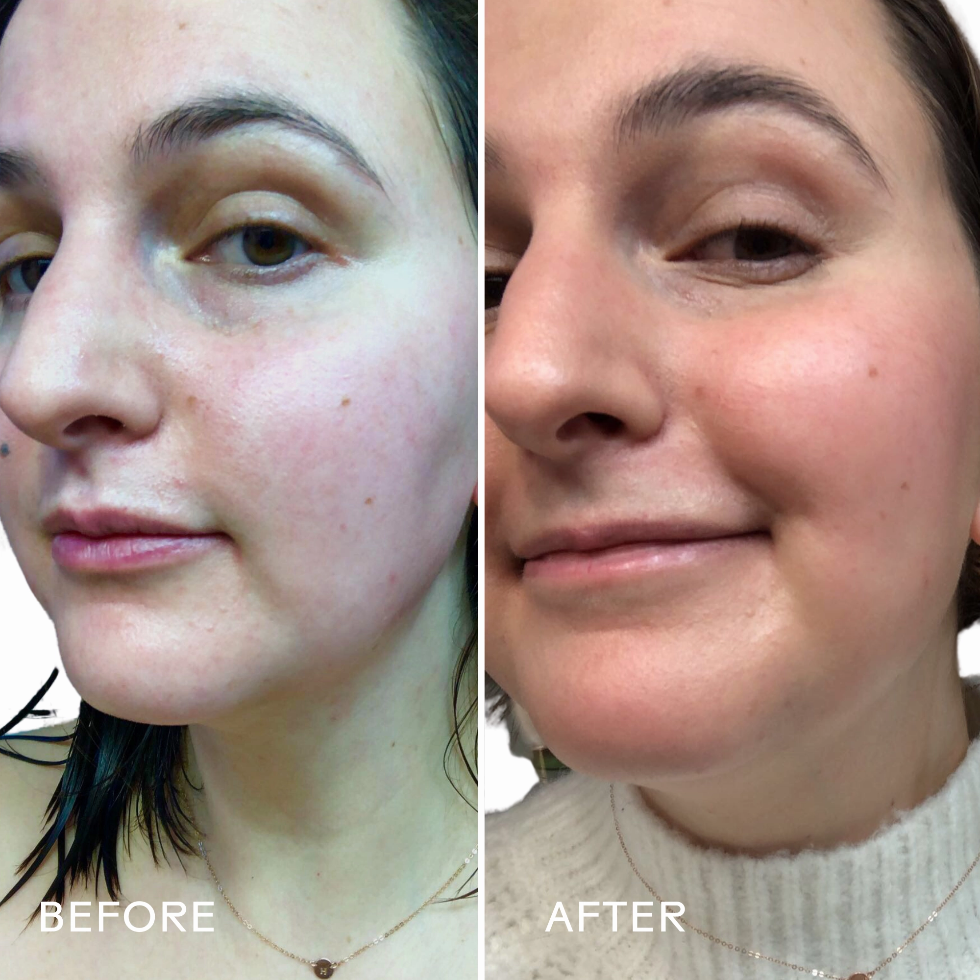 Boost 49% Rosehip Oil Serum