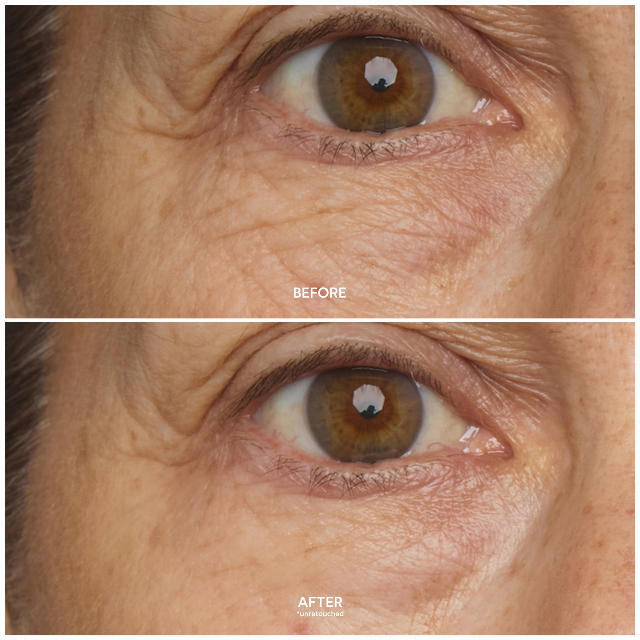 Chebula Multi-Corrective Eye Patches
