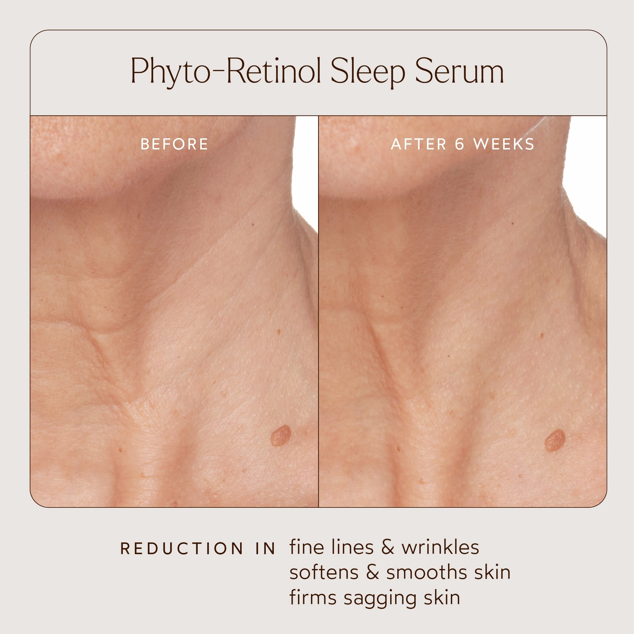 Phyto-Retinol Anti-Aging Sleep Serum