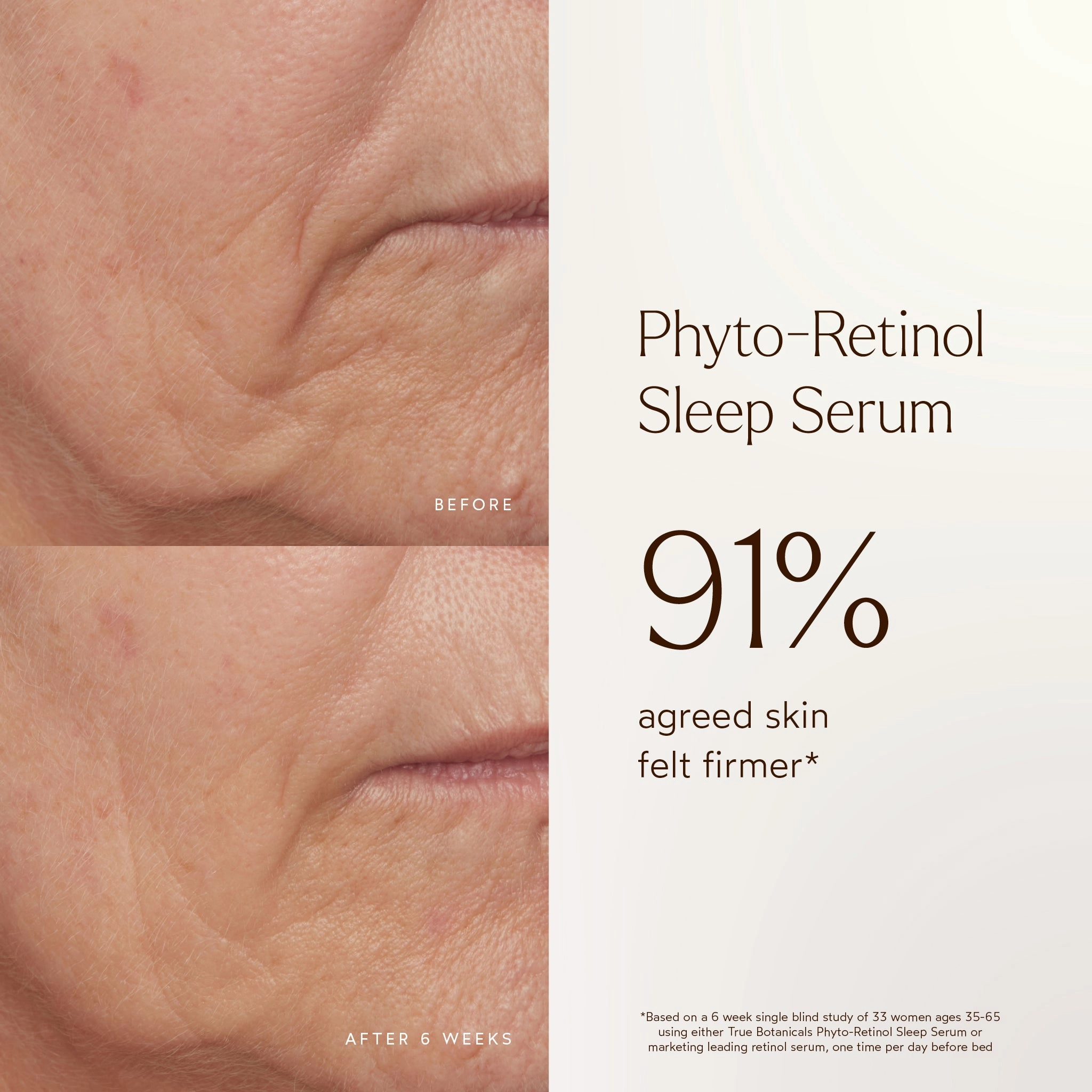 Phyto-Retinol Anti-Aging Sleep Serum