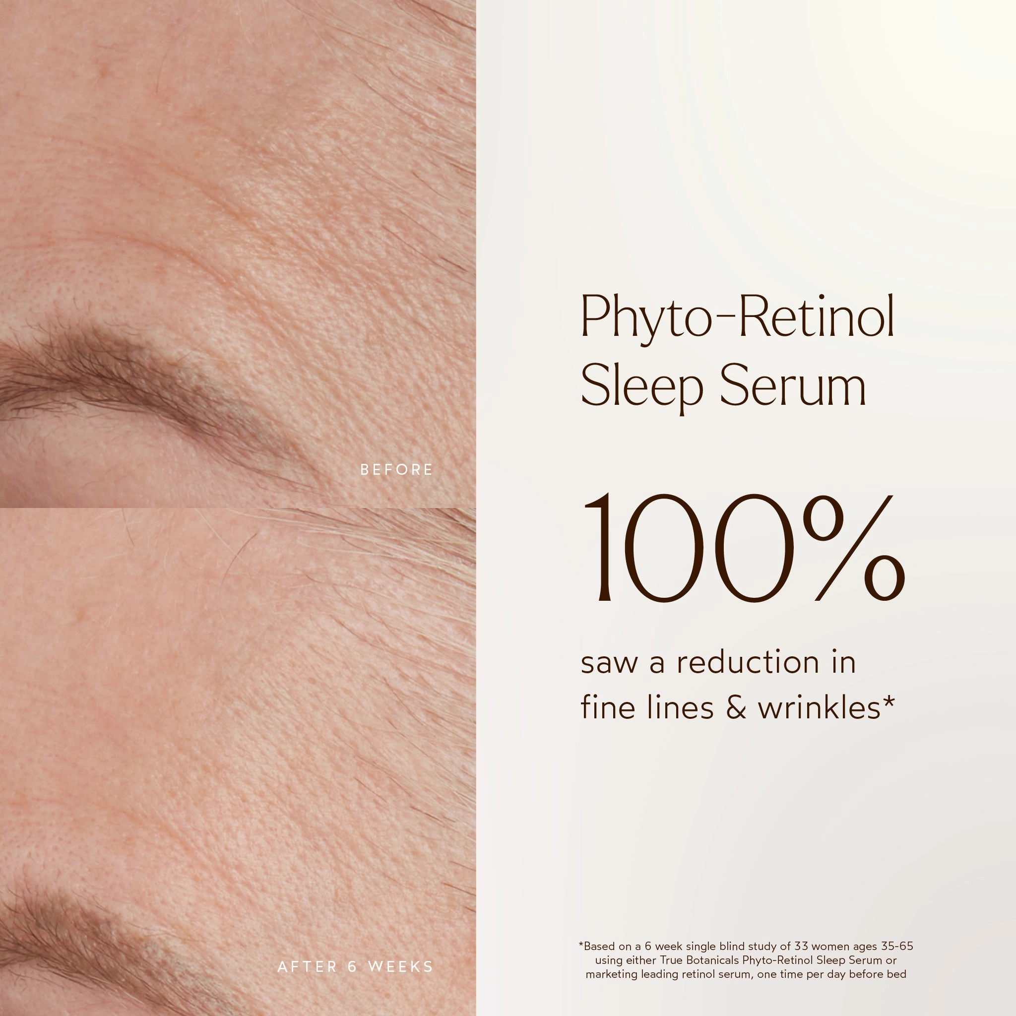 Phyto-Retinol Anti-Aging Sleep Serum